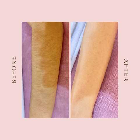 湘蠟過癮 - 手臂