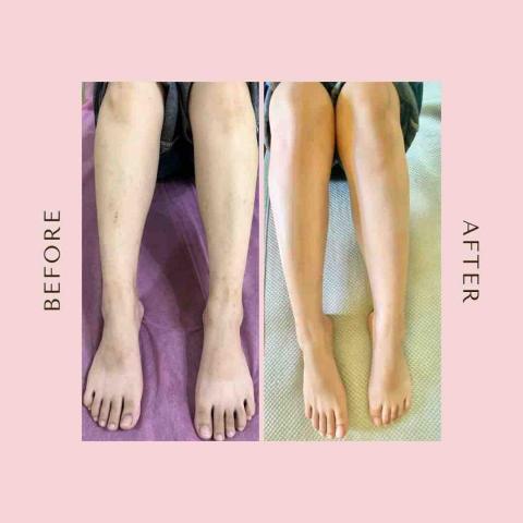 湘蠟過癮 - 小腿