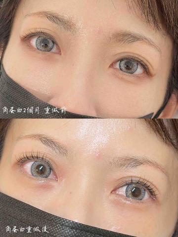 林口·洛庭 - 角蛋白