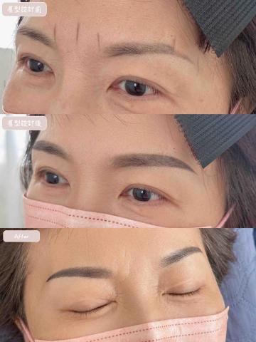 林口·洛庭 - 機器霧眉