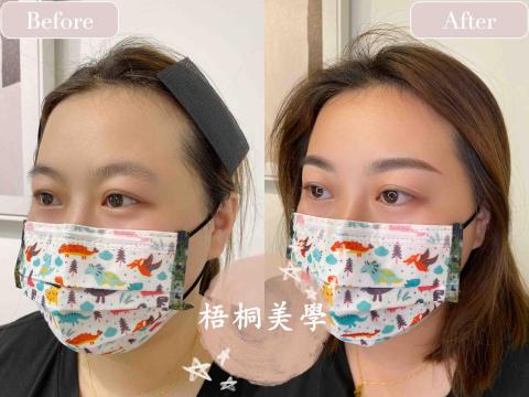 林口·洛庭 - 機器霧眉