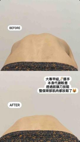 Curly_運動按摩🐑 - 背部筋膜刀放鬆後效果