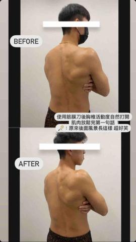 Curly_運動按摩🐑 - 筋膜刀放鬆後轉頭角度增加