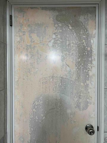 鍾小姐 - 霉菌-清潔前