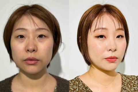 Ki喲打 彩妝造型/化妝教學/黑眼圈救星 - 韓系彩妝/黑眼圈淚溝遮瑕 Ki喲打 彩妝造型/化妝教學/黑眼圈救星 - 韓系彩妝/黑眼圈淚溝遮瑕