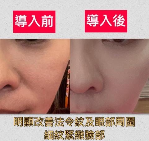 芮絜思SPA生活館 - 除皺安瓶導入