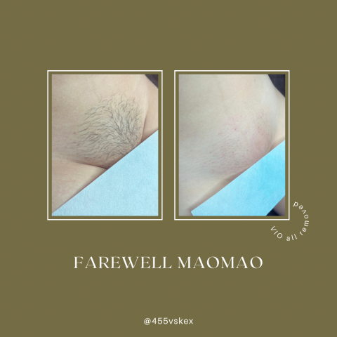 森森時尚美學 - VIO全除