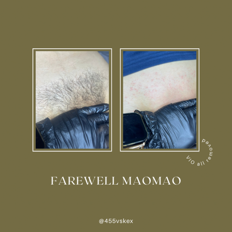 森森時尚美學 - 男性私密處全除