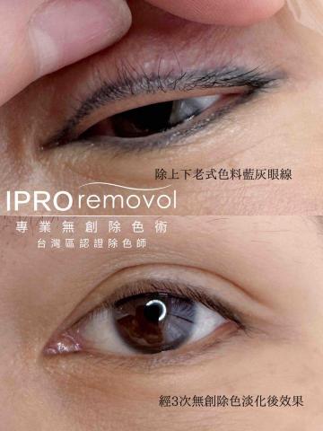 MILLER BEAUTY | 米樂美學苑 - 無創除眼線！不會燒掉睫毛！