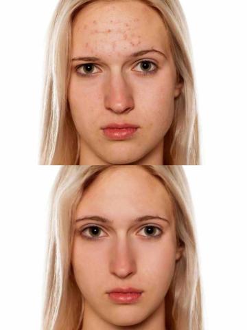 wen - 臉部協調度&皮膚修圖