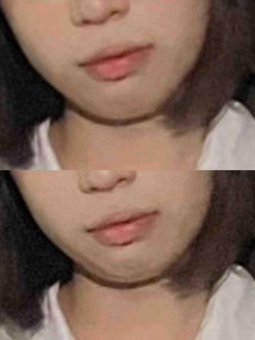 wen - 去除雙下巴