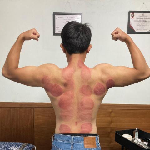 提供刮痧拔罐功效服務的專家李冠儒