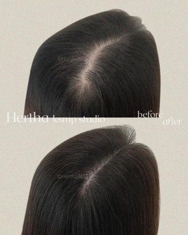 Hertha赫莎 KSMP韓國頭皮紋髮專門 - KSMP髮旋分線修飾填補-兩指寬|두피문신 Hertha赫莎 KSMP韓國頭皮紋髮專門 - KSMP髮旋分線修飾填補-兩指寬|두피문신
