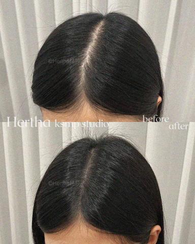 Hertha赫莎 KSMP韓國頭皮紋髮專門 - KSMP 女士髮分線填補增密|두피문신 Hertha赫莎 KSMP韓國頭皮紋髮專門 - KSMP 女士髮分線填補增密|두피문신