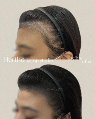 Hertha赫莎 KSMP韓國頭皮紋髮專門 - KSMP女士柔霧髮際線設計|두피문신 Hertha赫莎 KSMP韓國頭皮紋髮專門 - KSMP女士柔霧髮際線設計|두피문신