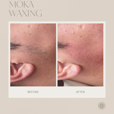MOKA媄妍|桃園紋繡·桃園熱蠟除毛 - 臉部除毛 MOKA媄妍|桃園紋繡·桃園熱蠟除毛 - 臉部除毛