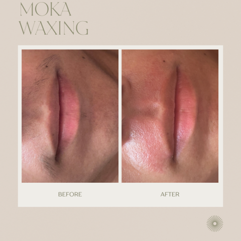 MOKA媄妍|桃園紋繡·桃園熱蠟除毛 - 鬍子除毛 MOKA媄妍|桃園紋繡·桃園熱蠟除毛 - 鬍子除毛