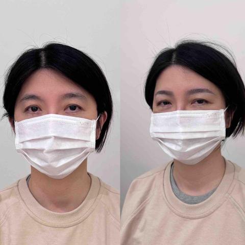 好皮製眉所 - 無蠟筆小新過渡期
後期不反紅
