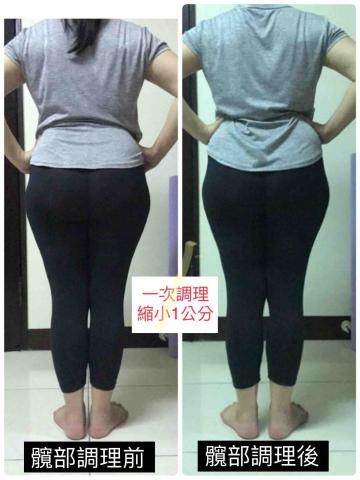 Brewing 波蘊/Zora（台中） - 髖部調理當天的成果