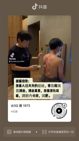 謝佩蓉 - 拔罐排毒