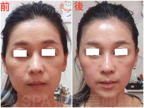 新莊-蓁SPA撥經美顏館 - 臉部：花晶小顏V