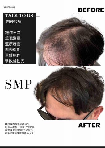 四茂紋髮|英式SMP紋髮|仿針毛囊|頭皮紋髮|落髮改善|疤痕 -  四茂紋髮|英式SMP紋髮|仿針毛囊|頭皮紋髮|落髮改善|疤痕 -