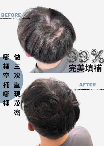 四茂紋髮|英式SMP紋髮|仿針毛囊|頭皮紋髮|落髮改善|疤痕 -  四茂紋髮|英式SMP紋髮|仿針毛囊|頭皮紋髮|落髮改善|疤痕 -