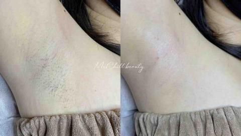 Miss Lazy&hearts;︎ 慵懶小姐 ꕥ 紋繡｜美睫｜除毛 - 