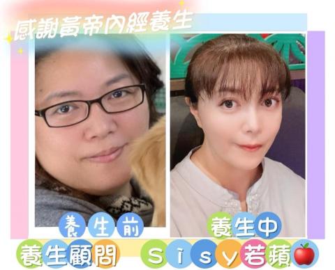 黃帝內經養生 - 養生前後
無需醫美
自然回歸