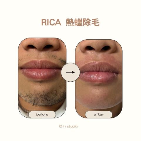 㹜 in studio - 鬍子熱蠟除毛