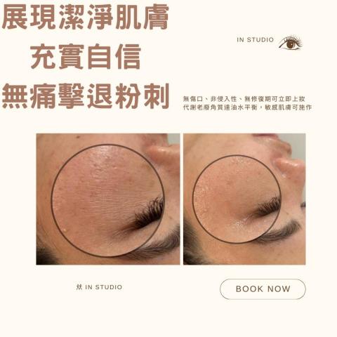 㹜 in studio - 韓式皮膚管理