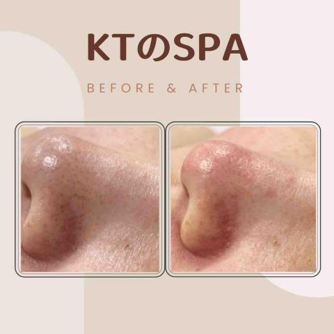 KT SPA - 