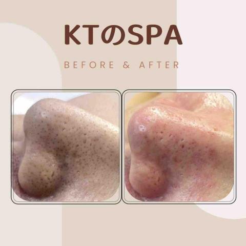 KT SPA - 