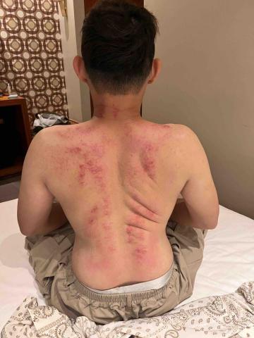 小太陽健康屋Fit nutrition -  大學生學員瘦下來，連姿勢不正確造成的肌肉擠壓都開始看得出來，進而可以調整！ 除了飲食身體經絡順暢也很重要❗️