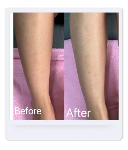 歆星工作室 - 小腿除毛