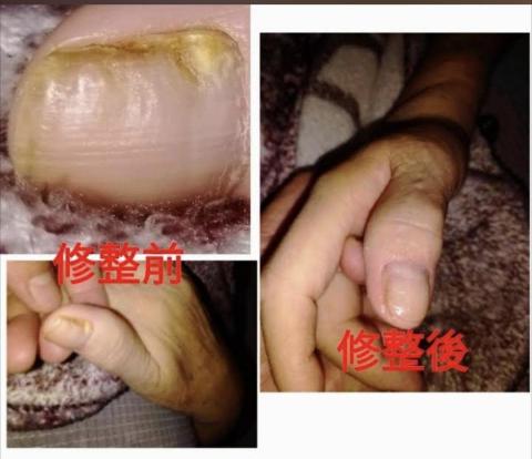 廖師傅 - 修整指甲