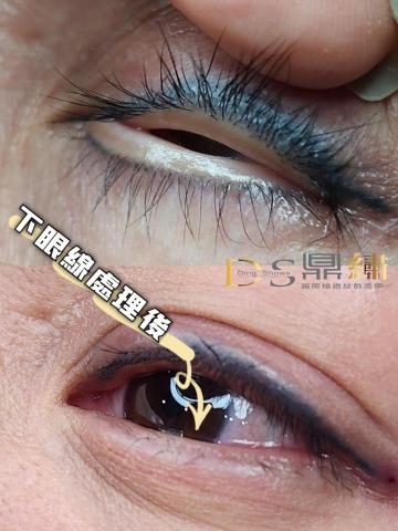 Ds鼎繡國際極緻紋飾美學~桃園民權總店 | 北投石牌店   - 洗眼線  Ds鼎繡國際極緻紋飾美學~桃園民權總店 | 北投石牌店   - 洗眼線