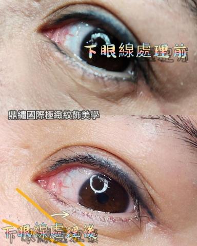 Ds鼎繡國際極緻紋飾美學~桃園民權總店 | 北投石牌店   - 洗眼線(洗下眼線) Ds鼎繡國際極緻紋飾美學~桃園民權總店 | 北投石牌店   - 洗眼線(洗下眼線)