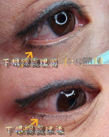 Ds鼎繡國際極緻紋飾美學~桃園民權總店 | 北投石牌店   - 洗眼線(洗下眼線) Ds鼎繡國際極緻紋飾美學~桃園民權總店 | 北投石牌店   - 洗眼線(洗下眼線)
