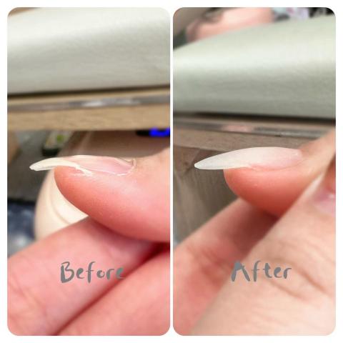 陳雨軒 - 修補、矯正指甲 陳雨軒 - 修補、矯正指甲