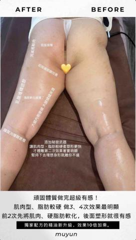 莯昀美學概念館 - 體態雕塑對比圖