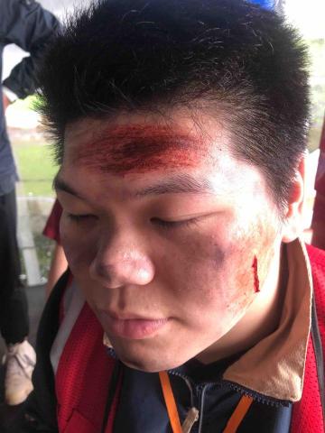 張梓涵 - 消防演習-爆炸現場傷患