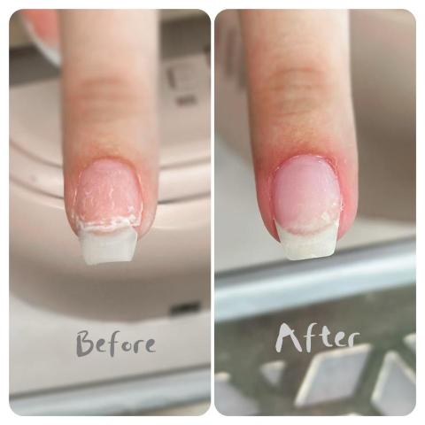 陳雨軒 - 修補指甲 陳雨軒 - 修補指甲