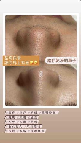 美美拾肌-問題肌膚美學 - 