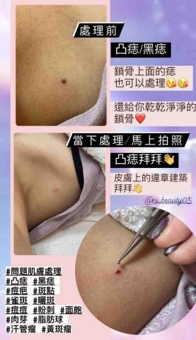 美美拾肌-問題肌膚美學 - 