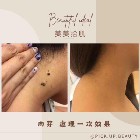 美美拾肌-問題肌膚美學 - 