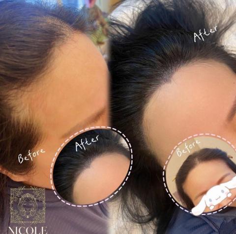 YI HSIN の舞妝美學 - 髮際線紋髮