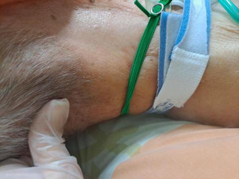 劉珏伶 - 協助管路護理