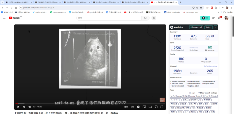 CHEN Yi Yi - 破百萬的觀看影片