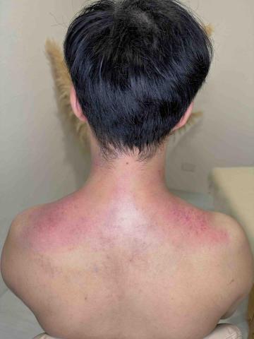 馧體態 - 上班族 長時間坐 肩膀痠痛